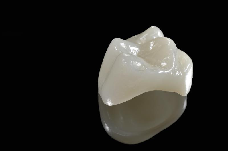 Porcelain Crowns  Oceanside, CA 
